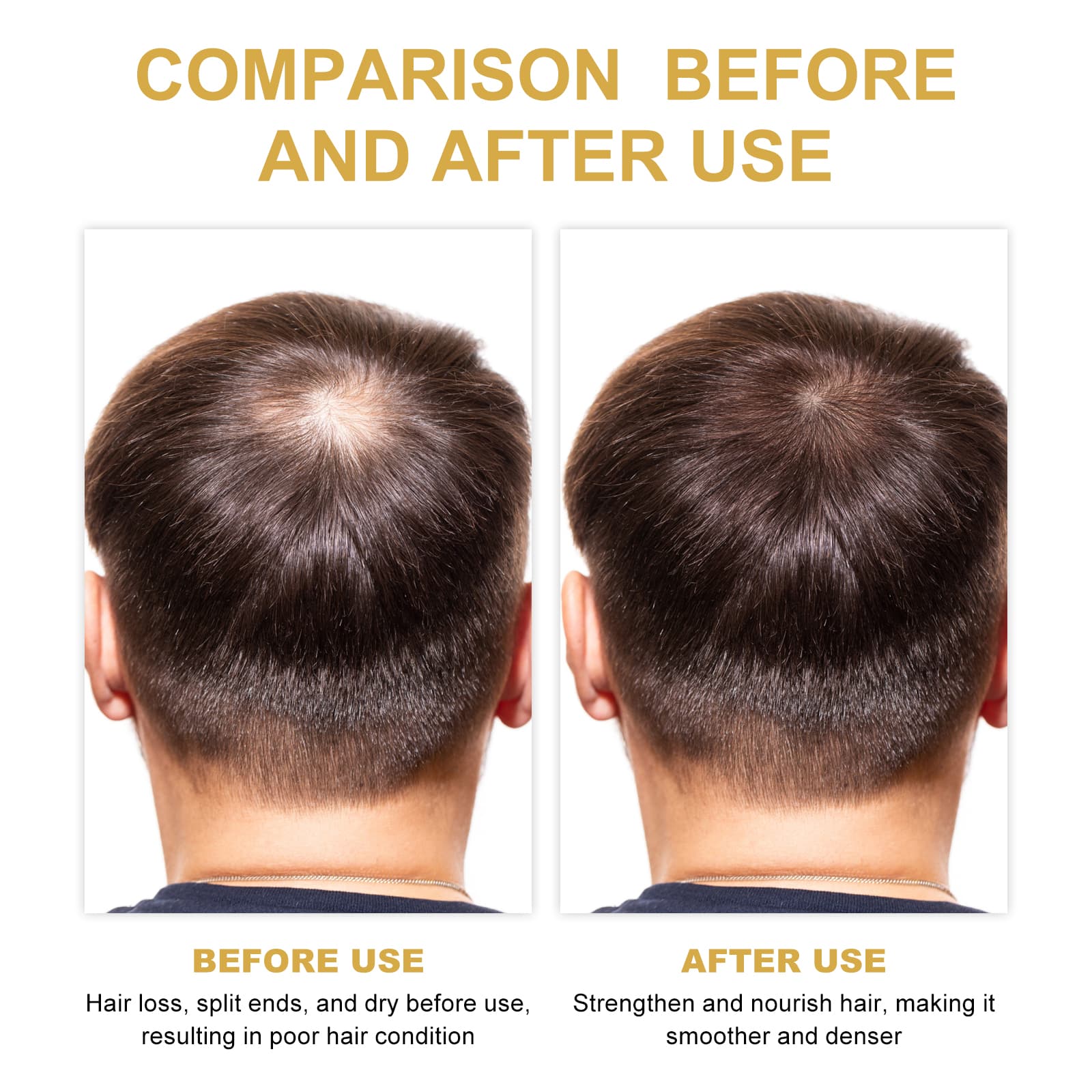 EELHOE Rosemary Hair Treatment Oil Scalp Cleansing Conditioning Volumizing Smoothing Repair Dry Frizzy Hair Conditioning Hair Treatment Oil 5